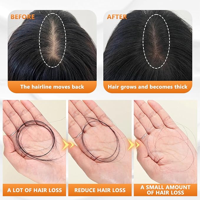 Anti-Hair Fall Hair Loss Shampoo, Anti Hair Loss Shampoo, Anti-Hair Fall Promote H air Growth Shampo o, Routine Shampo o for Women H air L oss, for All H air Types, 200ml (2pcs)