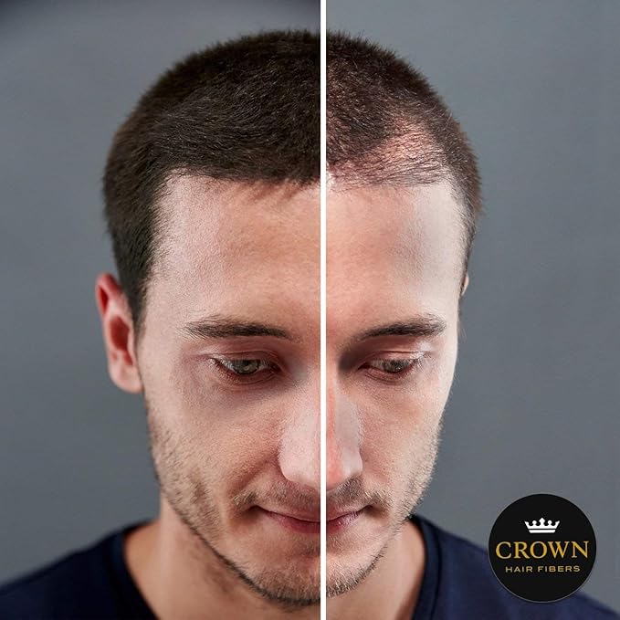 CROWN Hair Building Fibers (28g) - Instantly Cover Fine & Thinning Hair for a Thicker, Fuller Look - A Natural Keratin Concealer - 13 Shades for Men & Women - Gray
