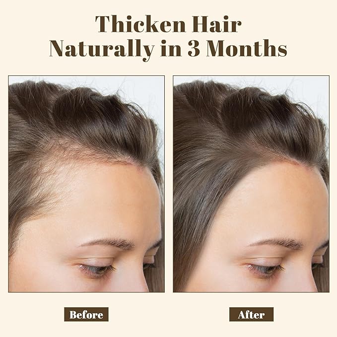 Ginger Hair Growth Shampoo, Thickening Shampoo 473 ml(16 fl.oz), For All Hair Types, with Herbal Essential Oils and Plant Extracts for Thinning Hair for Women and Men