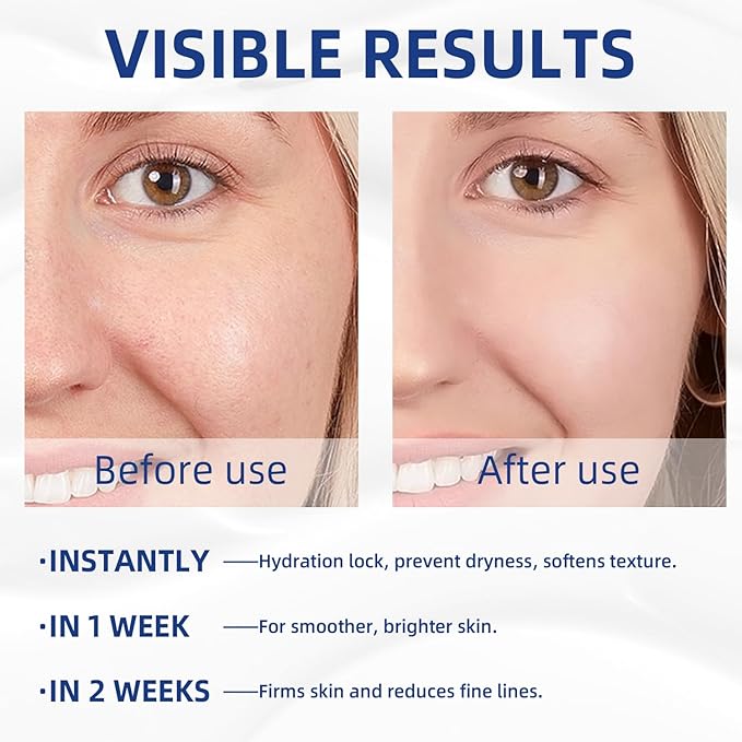 Retinol Vitamin C Cream, Face Moisturizer For Face, 2 In 1 Day & Night Face Moisturizer Cream, Daily Moisturizers, Hydrating Facial Moisturizer For Dry Skin, Lightweight Moisturizer 3.53 OZ