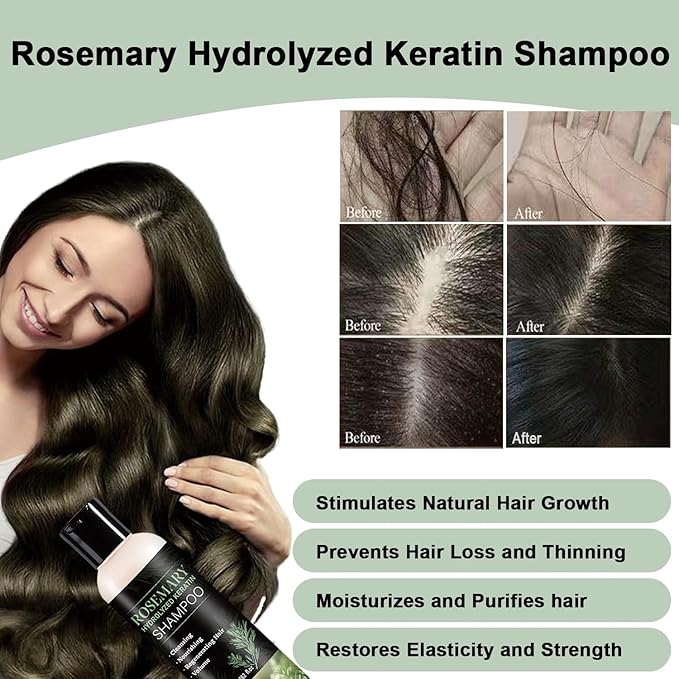 Rosemary Shampoo for Hair Growth, Natural Thickening & Strengthening Shampoo with Hydrolyzed Keratin, for Thinning Hair & Hair Loss for Women and Men 13.52 Fl Oz (Pack of 2))