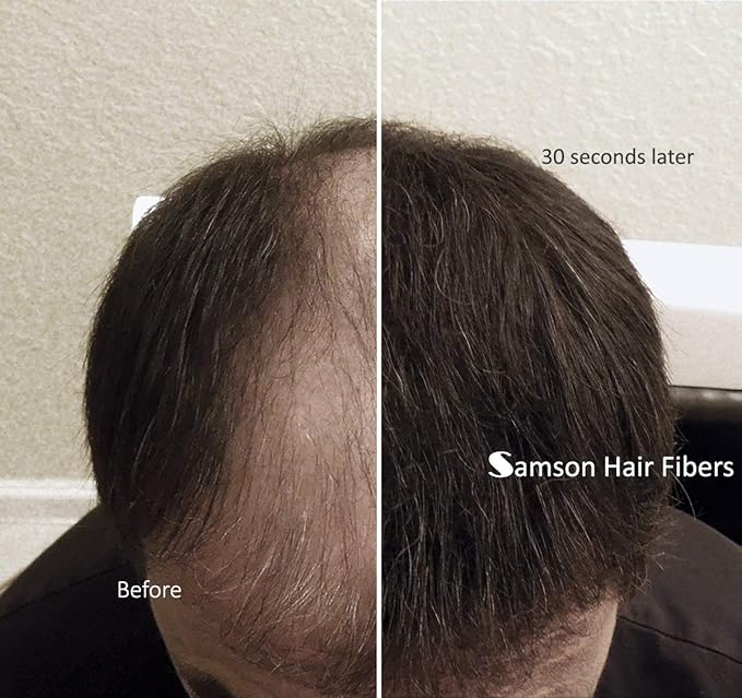 Samson Hair Building Fibers Refill Compatible with Toppik and other Top Brands Hair Loss Concealer for Thinning Hair 100% Undetectable Natural Formula Made in USA (BLACK 25gr Refill)