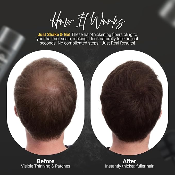 Herbishh Koloret Hair Building Fibers – Dark Brown Powder for Men & Women, Instant Bald Spot Cover-Up & Scalp Concealer – Sweat-Proof & Water-Resistant Fibers for Thinning Hair, 12g (Pack of 2)