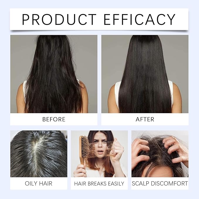 30ml Hair Growth Serum Roll-On for Thinning Hair – Stimulates Follicles, Strengthens Roots & Boosts Density with Rosemary & Biotin – Non-Greasy Scalp Treatment for Men and Women