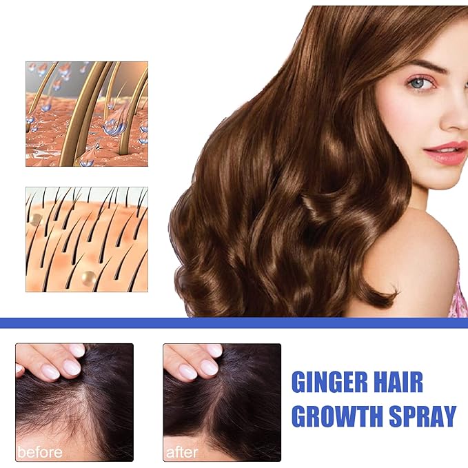 Ginger Hair Growth Spray for Men & Women, 30ml Anti-Hair Loss Treatment, Scalp Nourishing & Follicle Activation, Natural Ginger Extract for Thicker & Fuller Hair