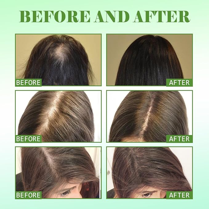 Rosemary Mint Scalp & Hair Strengthening Oil, Natural Ingredients with Jojoba Oil, Anti-Hair Loss Treatment for All Hair Types, 2.02 fl oz Glass Bottle with Dropper
