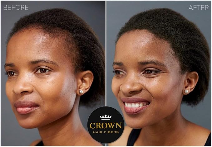 CROWN Hair Building Fibers (28g) - Instantly Cover Fine & Thinning Hair for a Thicker, Fuller Look - A Natural Keratin Concealer - 13 Shades for Men & Women - Medium Blonde