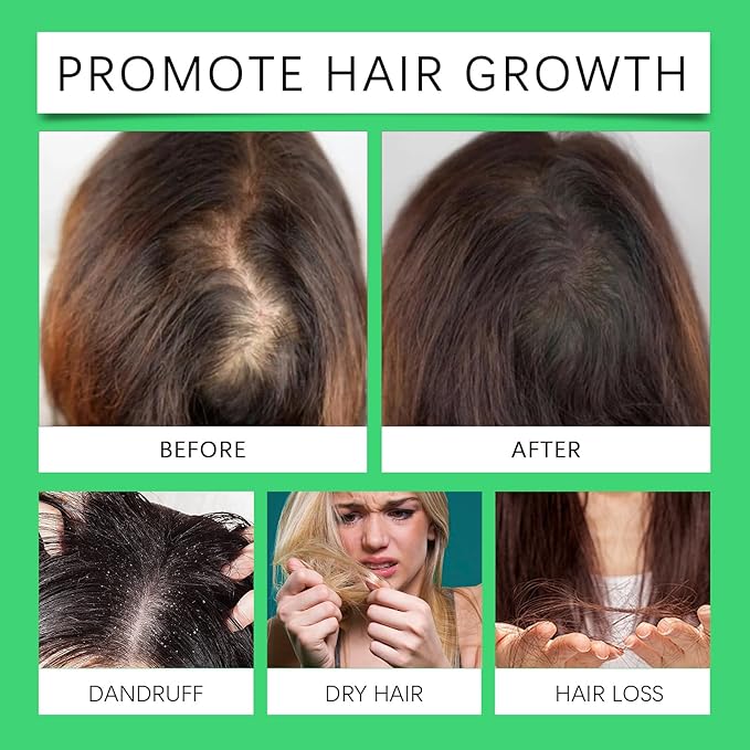 Organic Hair Growth， Rosemary & Batana Oil for Scalp & Hair Strengthening，All Hair Types Treatment Oil (2 Pcs)