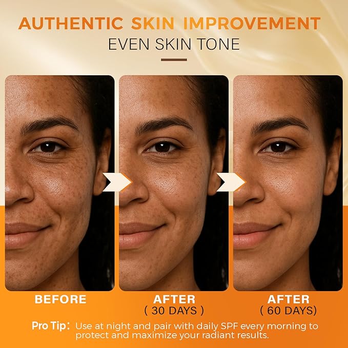 QOOQ Turmeric Kojic Acid Soap for Dark Spots Remover – Facial Cleansing Bar with Vitamin C, Retinol, Collagen, Vitamin E, Glycerin, Shea Butter & Castile Olive Oil – Soap for Women & Men (120g x 2)