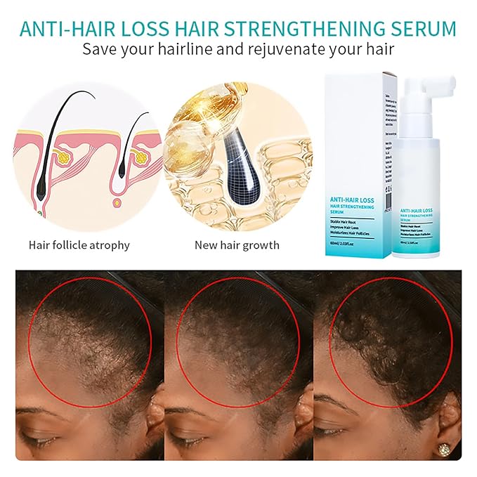 Hair Care Essence Spray with Anti-hair Loss Serum，Rich in Biotin, Oriental Leaf Extract to Nourish the Skin and Condition the Hair,Suitable for All Hair Types，2.1oz(1pcs)