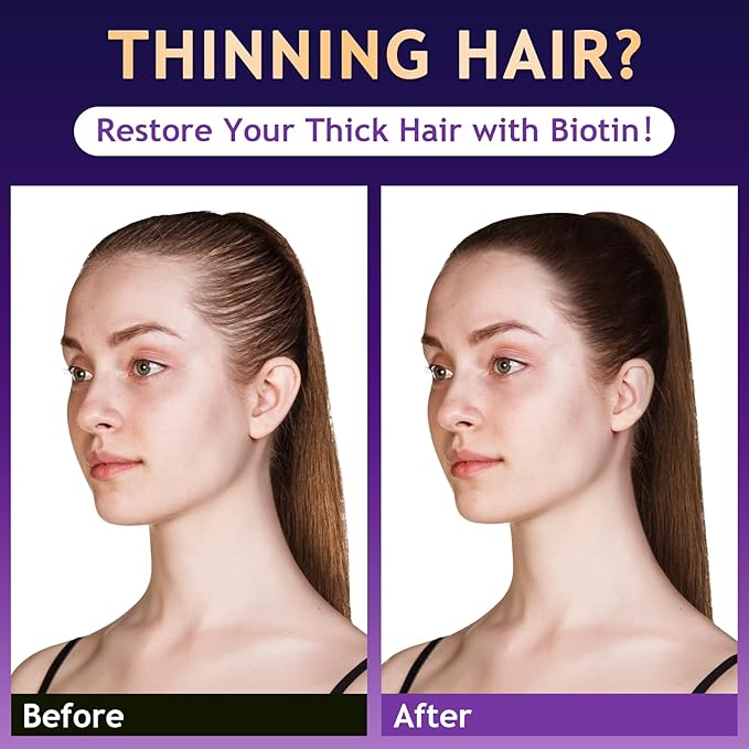 Biotin Hair Growth & Thickening Shampoo with Root Activator, Hair Loss Shampoo for Men And Women, Strengthen Roots, Control Oil & Thicken Thin Hair, Sulfate-Free, for All Hair Types, 10.1 Fl Oz-Fresh