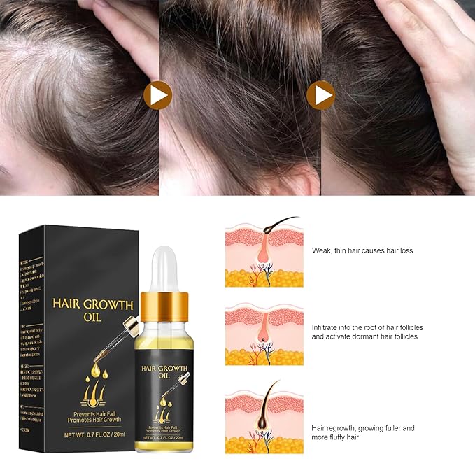 20ml Hair Growth Oil for Thinning Hair – Stimulates Hair Regrowth, Reduces Hair Fall & Boosts Volume with Rosemary & Ginger Extract
