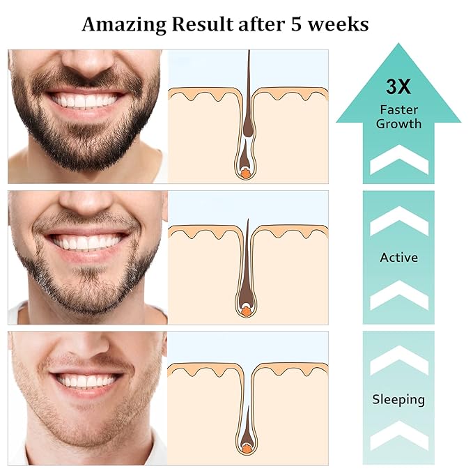 Beard Growth Kit, Upgraded Beard Growth Oil (2Oz) w/3 X Thickening Biotin & Castor Oil for Spot/Patchy Beard, Achieve Fuller, Thicker & Healthier Beards, Birthday Gifts for Men Him Boyfriend Husband