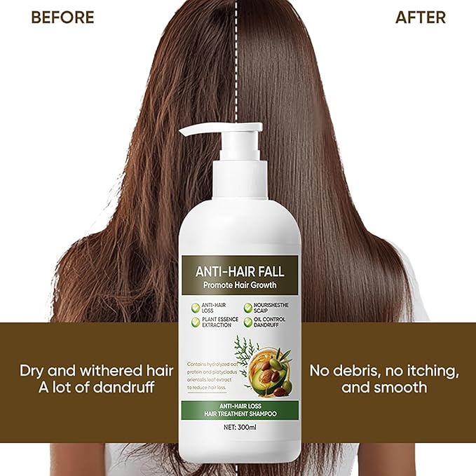 10.14 fl Oz Anti Hair Loss & Hair Fall Shampoo for Women - Daily Routine Shampoo to Strengthen Roots, Prevent Hair Loss & Nourish for Voluminous, Hydrated Hair