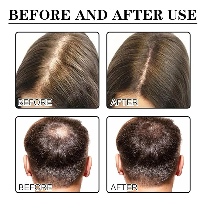 Hair Care Growth Oil, Hairs Growth Products, For All Hair Types, to Make Your Hairs Long (3PCS)