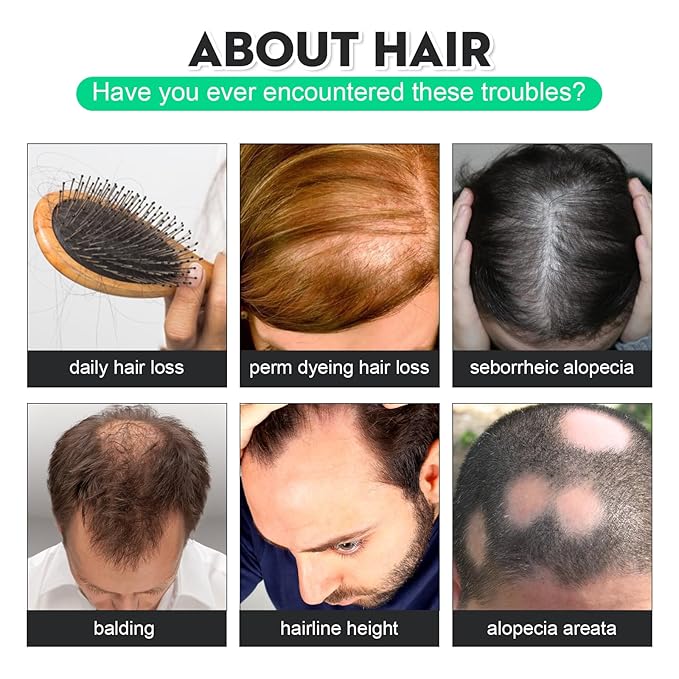 120ml Hair Growth Serum for Men - Hair Loss Treatment & Thinning Hair Solution with Ginseng & Ginger Extract - Hair Root Nutrient Essence for Stronger Hair & Scalp Care