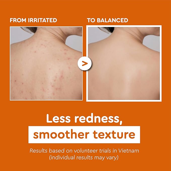 VIETNAM Turmeric Exfoliating Body Wash for Women & Men, Gentle Ginger Body Wash for Sensitive Skin, Moisturizing Shower Gel, Paraben & Silicone Free (17.64 oz) COCAY HOALA
