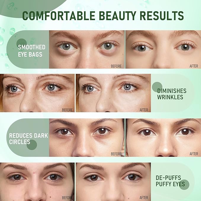 LAVONE Eye Mask - 30 Pairs Seaweed Under Eye Patches Skin Care Products - Eye Masks Skincare for Dark Circles and Puffiness, Reduce Wrinkles, Eye Bags and Fine Lines, for Women and Man
