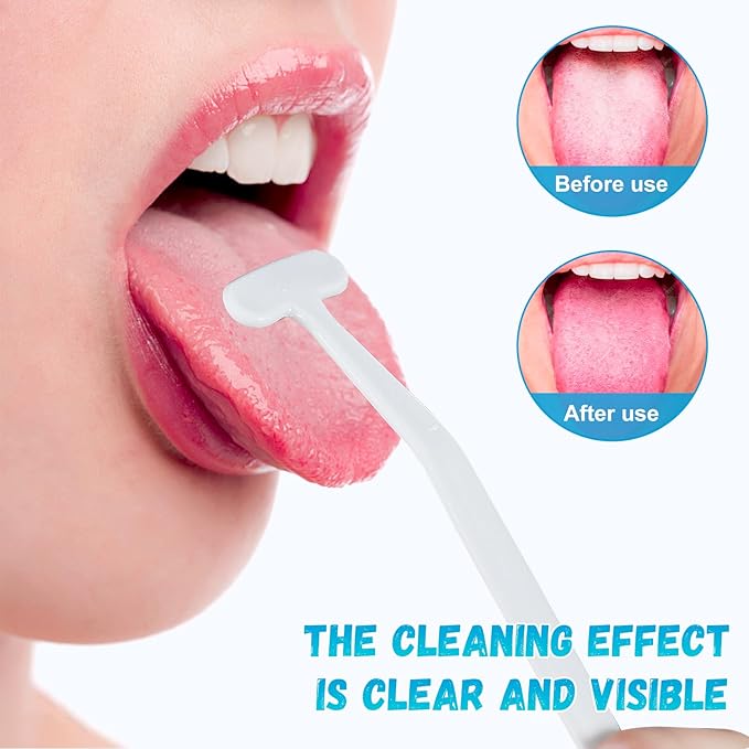 6 Pack Tongue Scraper, Plastic Tongue Cleaner Brush for Adults Tongue Scrubber for Better Breath Dental Oral Care Supplies (6 Pcs Tongue Scraper)
