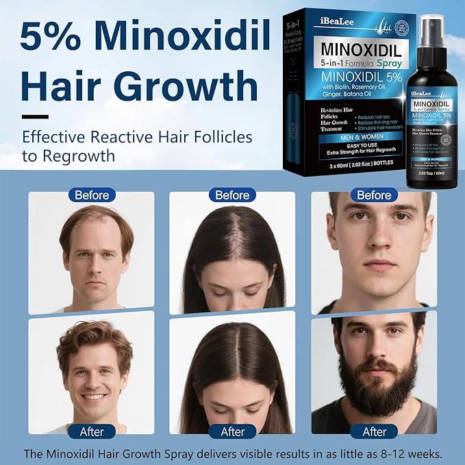 5% Minoxidil for Men and Women Hair Growth, Hair Loss Treatments Serum with Biotin Batana and Rosemary, Minoxidil Hair Growth Spray for Stronger Thicker Fuller Hair Beard Regrowth, 3 Bottles