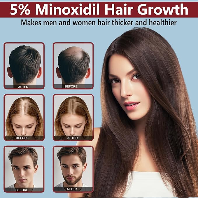 5% Minoxidil for Men and Women Hair Growth Cream, Topical Minoxidil Hair Growth Products, Extra Strength Hair Regrowth Treatments for Stronger Thicker Fuller Hair, 2 Bottles