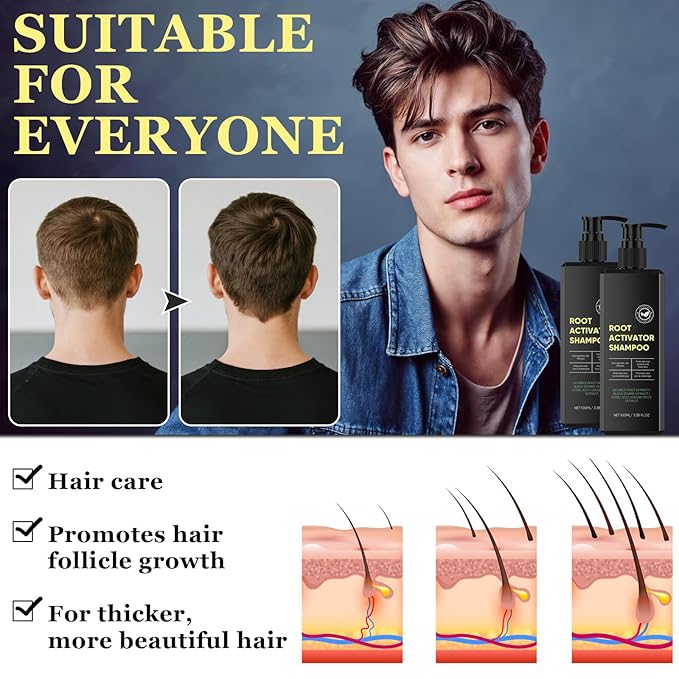 2 Pack Root Activator Shampoo for Men,Hair Growth Shampoo for Hair Loss and Thinning Hair,Thickening & Nourishing for All Hair,Natural Formula for Men and Women