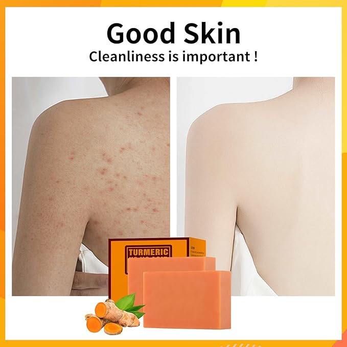 Turmeric Kojic Acid Soap Bar, Kojic Acid Soap for Face Body Hands, Deep Cleansing Natural Curcuma Bath Soaps Bar, Facial Cleanser Body Wash for Acne Blemish 2 Bars- 7OZ