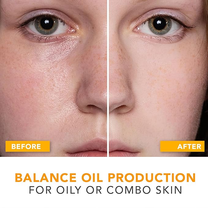 Oil Control Face Moisturizer - USA Made with Natural & Organic Ingredients, Lightweight and Mattifying Moisturizer for Oily & Acne Prone Skin, Face Cream with Niacinamide and Hyaluronic Acid