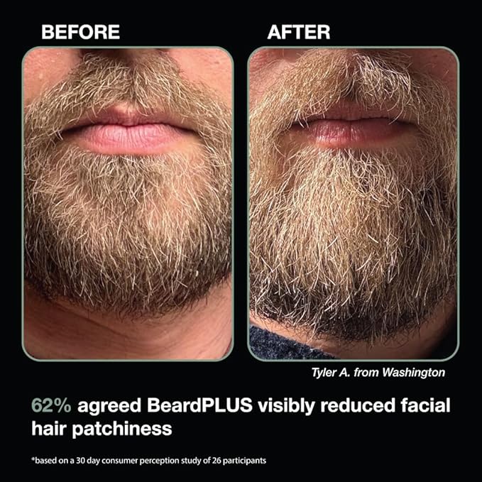 ZEUS BeardPlus Growth Serum for Men, Refined Beard Oil with Biotin, Caffeine & Collagen for Thicker, Fuller, Softer Facial Hair & Healthy Skin Care (Made in USA) 1.6 oz