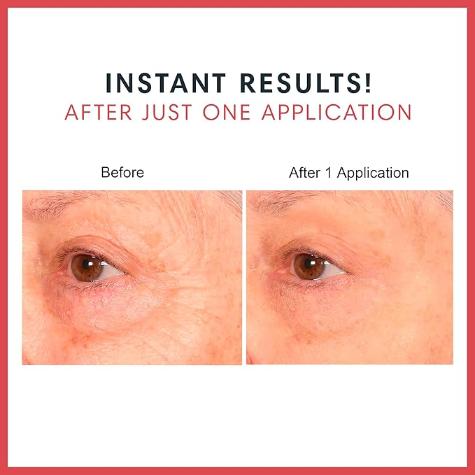 Consult Beaute Real-EYEZ-ATION Tinted Instant Firming Eye Gel - For Puffy Under Eyes - Temporary Eye Lid Lift - Illuminating - For Collagen and Elastin Production - Women and Men - .5 Fl. Oz