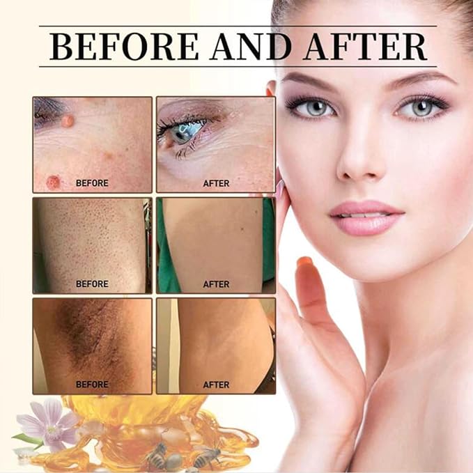 Bee Venom Repair Cream, Hydrating Moisturizing Cream, Natural Honey Bee Venom Repair Cream Remove Spots for Men&Women, Bee Venom Moisturizing Cream for All Parts of the Body 2 OZ