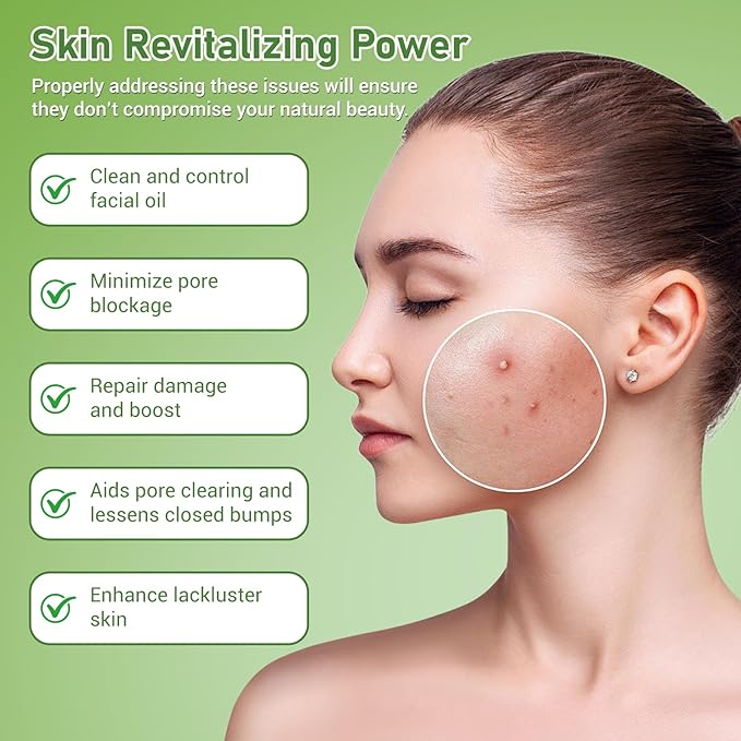 14% Azelaic Acid Acne Cream, Azelaic Acid For Face, Helps Improve the Appearance of Acnes - Azalecic Acids Acido Azelaico, 1 Fl Oz