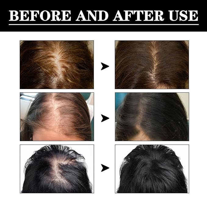 Hair Care Growth Oil, Hairs Growth Products, For All Hair Types, to Make Your Hairs Long (3PCS)