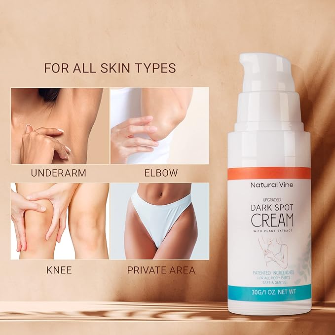 Natural Vine Dark Spot Corrector Cream: Dark Spot Remover for Body in 4-8 Weeks - Instant Concealing & Age Brown Sun Faded Spot Remover Melasma Freckles Correcting with Niacinamide, 1 OZ/30g