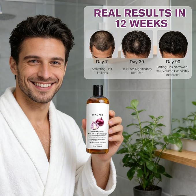 Rosemary Shampoo with Onion & Biotin,Shampoo,With Rosemary Oil, Red Onion, Cinnamon, Effectively Prevent Hair Loss,Support Hair Regrowth For Women Men