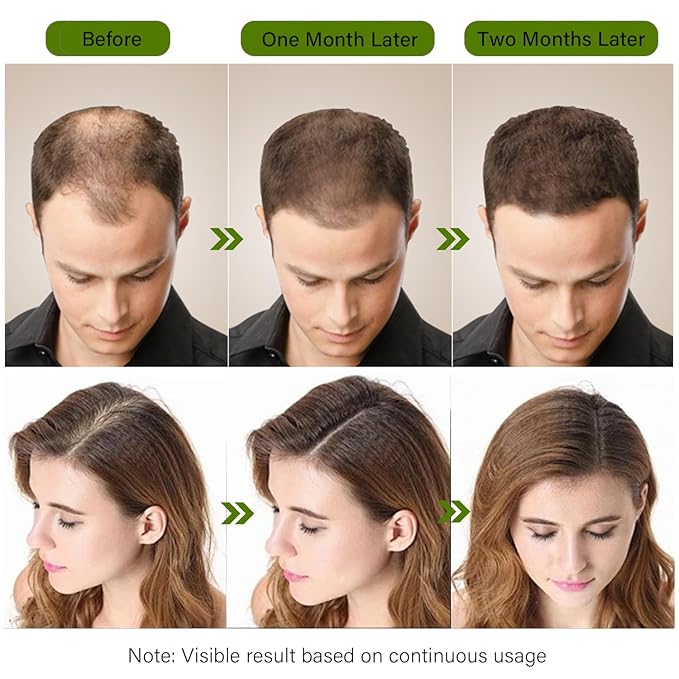 Hair Regrowth System, Hair Growth Treatment for Fuller & Thicker Looking Hair, Hair Growth Serum Infused with Ginseng & Ginger Extract, Hair Thickening Solution, Helps Prevent Hair Loss