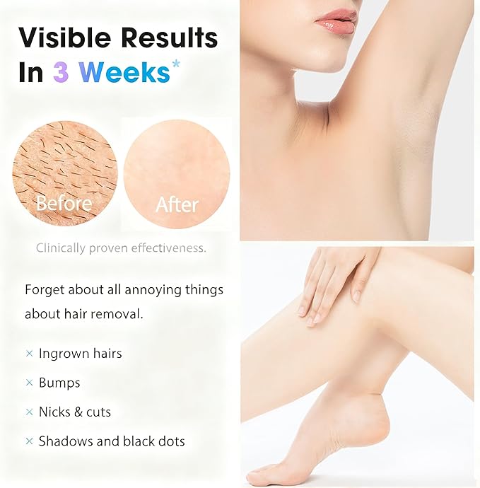 IPL Laser Hair Removal Device for Women & Men - at-Home Safe Painless Permanent Hair Reduction, 85% Hair Reduction in 4 Weeks, One-Button Control, Full Body & Face, Effective Salon Alternative