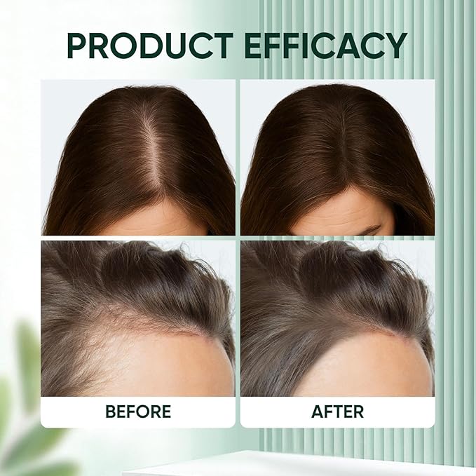 PDRN Hair Growth Ampoule (2pcs) - Hair Serum with Black Soybean & Wild Ginseng Extract, Nourishes Follicles, Reduces Hair Loss, Strengthens Strands & Balances Scalp