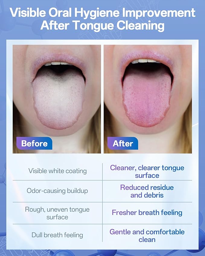 BodyAccel Silicone Tongue Cleaner for Adults, Soft & Gentle Tongue Brush and Scraper, Helps Remove Bad Breath, Flexible Non-Slip Handle for Comfortable Control