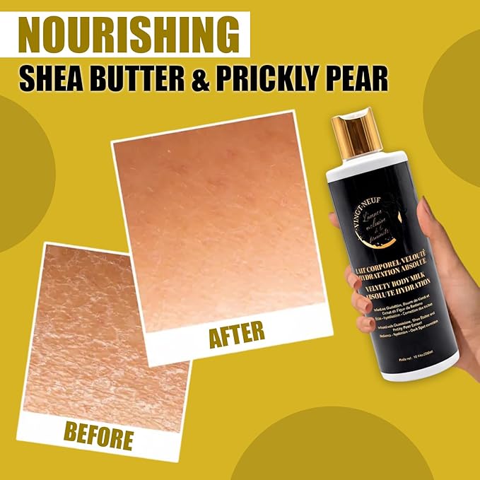 Nourishing Body Lotion With Shea Butter & Prickly Pear | Niacinamide & Collagen & Hyaluronic Acid Body Milk | Body Moisturizer & Radiance-enhancing Skin | Unscented Body Lotion (300ml)