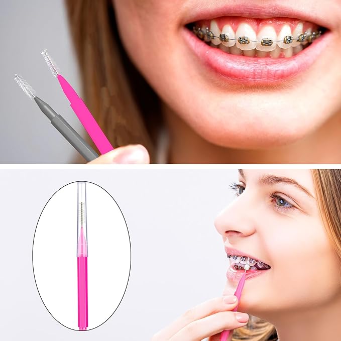 Patelai 100 Pieces Braces Brush for Cleaner Interdental Brush Toothpick Dental Tooth Flossing Head Oral Dental Hygiene Flosser Toothpick Cleaners Tooth Tool(Pink, Grey,Ideal Size)