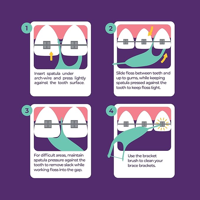 Platypus Orthodontic Flossers for Braces, 30 Count (Pack of 5), Ortho Picks for Adults & Kids, Fits Under Arch Wire, Non-Damaging, Encourage Flossing Habits