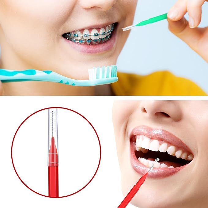 Patelai 100 Pieces Braces Brush for Cleaner Interdental Brush Toothpick Dental Tooth Flossing Head Oral Dental Hygiene Flosser Toothpick Cleaners Tooth Tool(Green, Red,Proper Size)