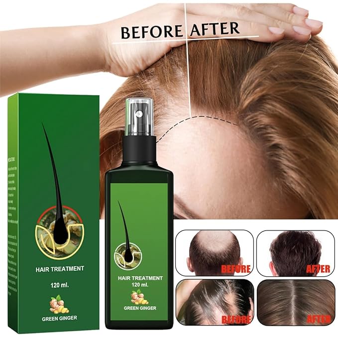Ginger Hair Growth Serum with Ginger Oil - Anti Hair Loss Treatment, Promotes Thicker, Fuller and Faster Growing Hair (4 FL OZ) (1 Pcs)