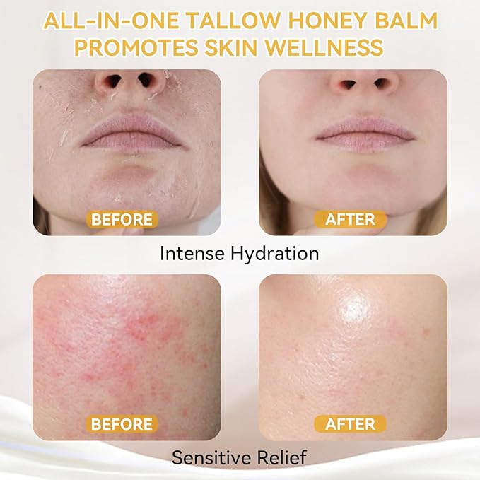 Beef Tallow for Skin, Tallow and Honey Balm, Grass-Fed Beef Tallow Moisturizer for Face & Body with Raw Honey & Beeswax, 4.2 Fl Oz