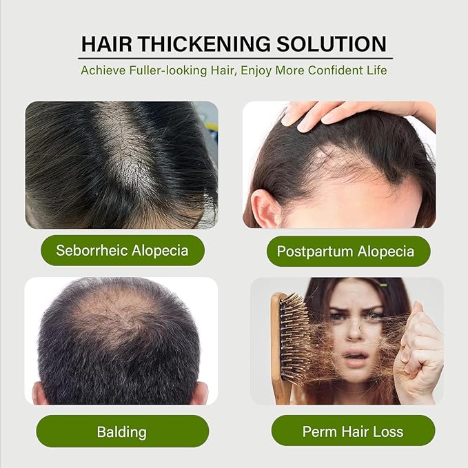 Hair Regrowth System, Hair Growth Treatment for Fuller & Thicker Looking Hair, Hair Growth Serum Infused with Ginseng & Ginger Extract, Hair Thickening Solution, Helps Prevent Hair Loss