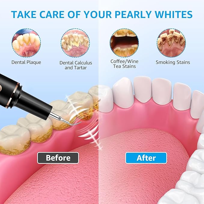 Teeth Cleaning Kit Plaque Remover for Teeth, Portable Dental Plaque Remover Tool with LED, Plaque Blaster for Human Teeth with 3 Modes, Tooth Scraper Plaque Tartar Remover for Teeth with Dental Tools
