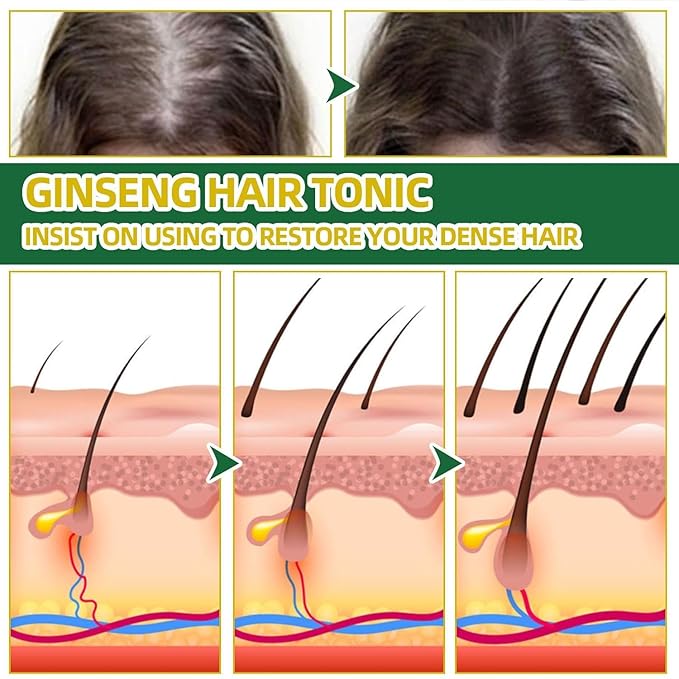Hair Growth Spray, Tonico Para Crecimiento Del Cabello, Natural Herbs Ginseng Hair Tonic, Stronger and Hair Thickening, Non-greasy Nourishing Hair Mist for Women & Men (2 Pcs)