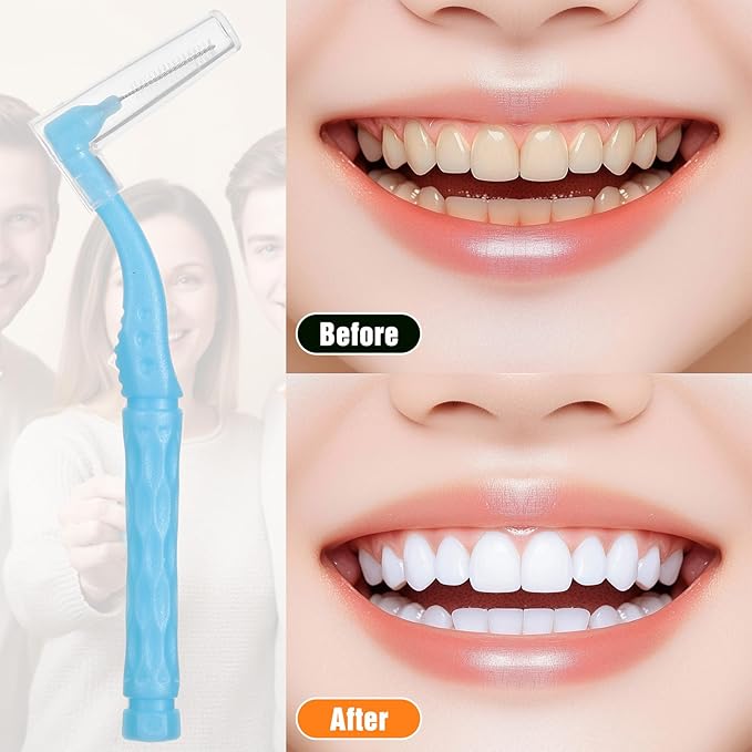 150pcs L-Shaped Interdental Brushes, 5 Sizes Soft Dental Brushes with Non-Slip Handle, Angled Head Tooth Picks for Braces, Implants, and Oral Cleaning