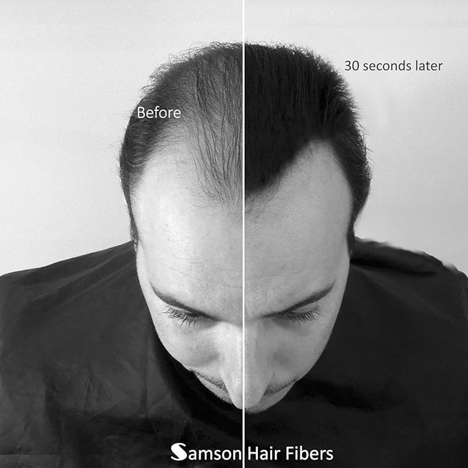 Samson Hair Building Fibers Refill Compatible with Toppik and other Top Brands Hair Loss Concealer for Thinning Hair 100% Undetectable Natural Formula Made in USA (BLACK 25gr Refill)